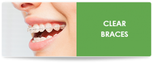 Clear braces header
