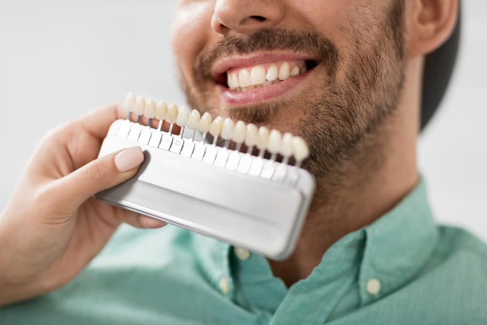 Medicine,,Dentistry,And,Healthcare,Concept,-,Close,Up,Of,Dentist We match a man's teeth to our porcelain veneers color options.